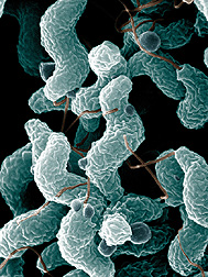 Thumbnail image for campylobacter.jpg