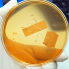 Foodborne Illness