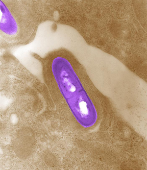 Listeria-monocytogenes11.jpg