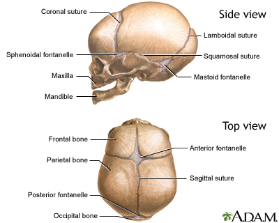 Paxil Lawyer Prozac Lawyer Zoloft Lawyer Celexa Lawyer SSRI Birth Defect Lawsuit SSRI Attorney - Skull of a Newborn