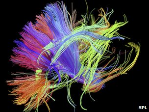 Human brain
