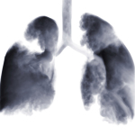 Asbestos Litigation Asbestos Litigation
