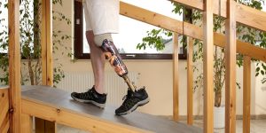 personal-injury-claim-and-prosthetic-limbs-napoli-shkolnik-300x150.jpg