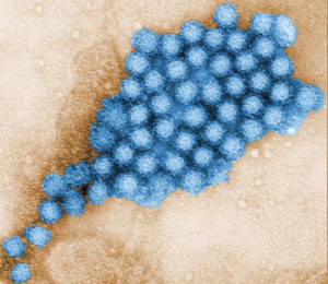 norovirus