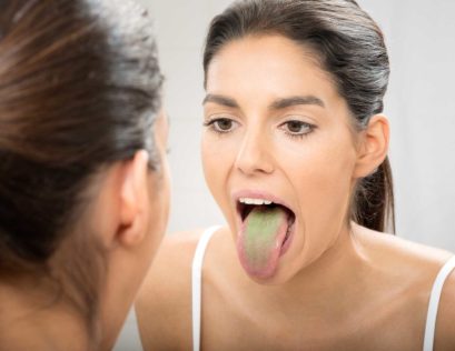 https-i0-wp-com-www-grahamlawyerblog-com-wp-content-uploads-2019-05-green-tongue-revisited-052819s-1024x789-jpgresize409%2c316