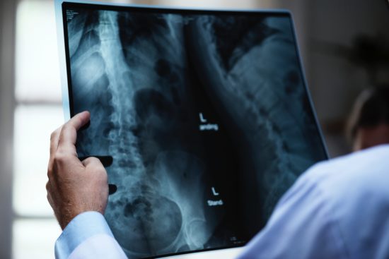 backbone-blur-check-721166