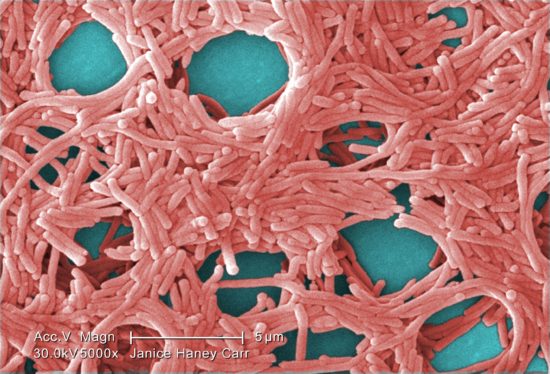 A large grouping of gram-negative <i>Legionella pneumophila</i> bacteria