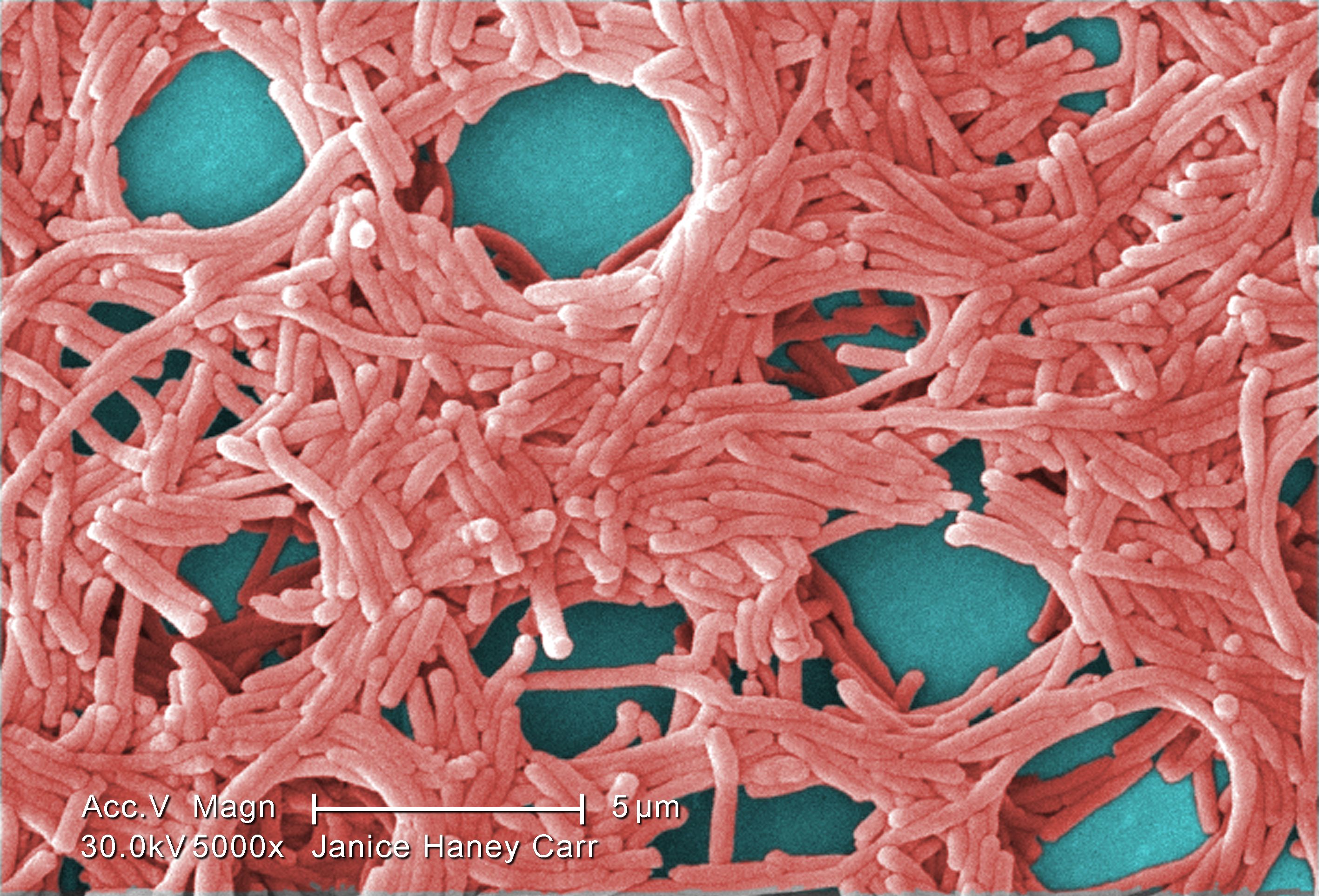 A large grouping of gram-negative <i>Legionella pneumophila</i> bacteria