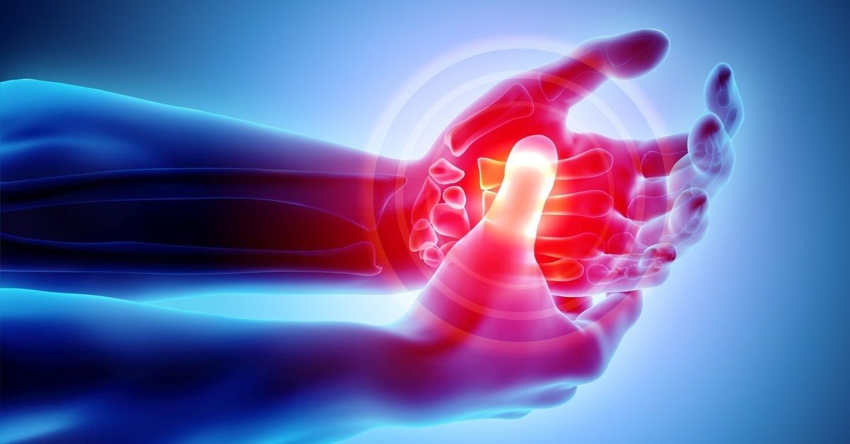 illustration-palm-painful---sk_1200