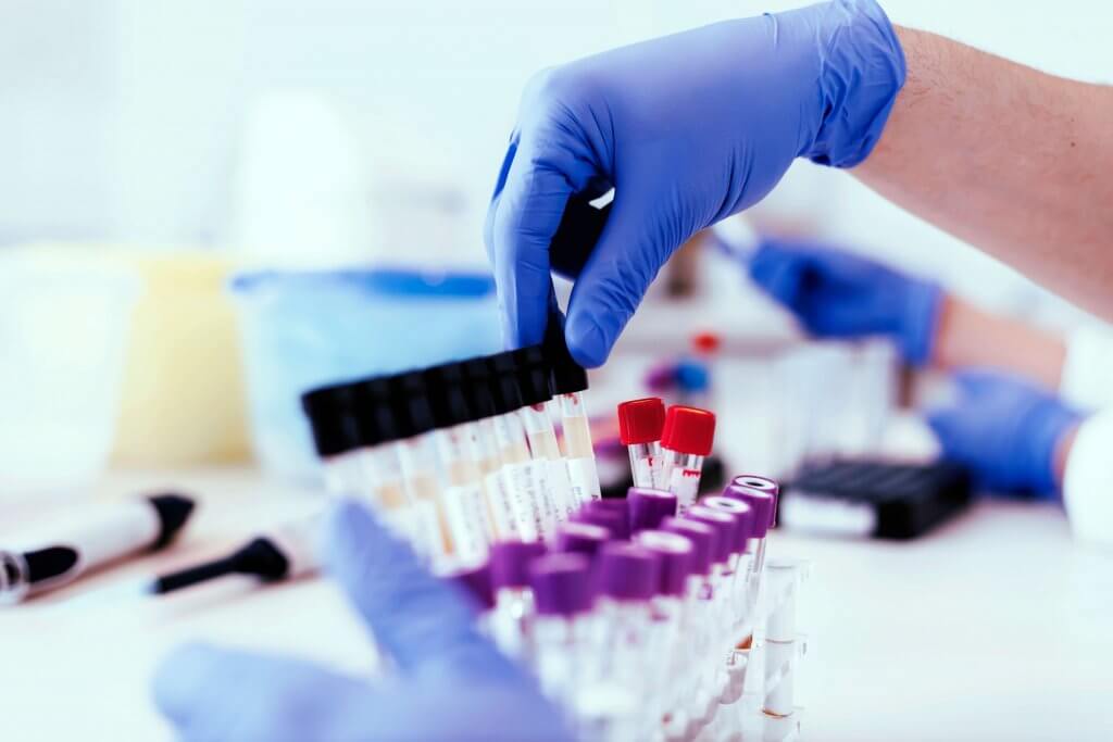 https-ogletree-com-app-uploads-insights-drug-testing-drugtesting_gettyimages-1013559310-1024x683-jpg