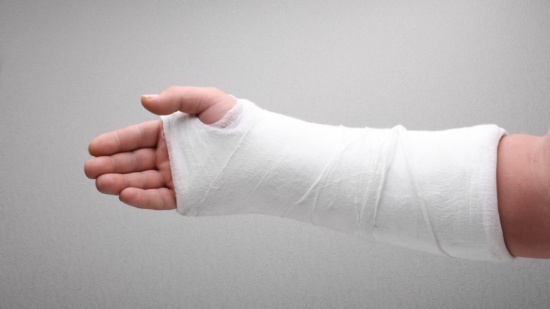 Cast