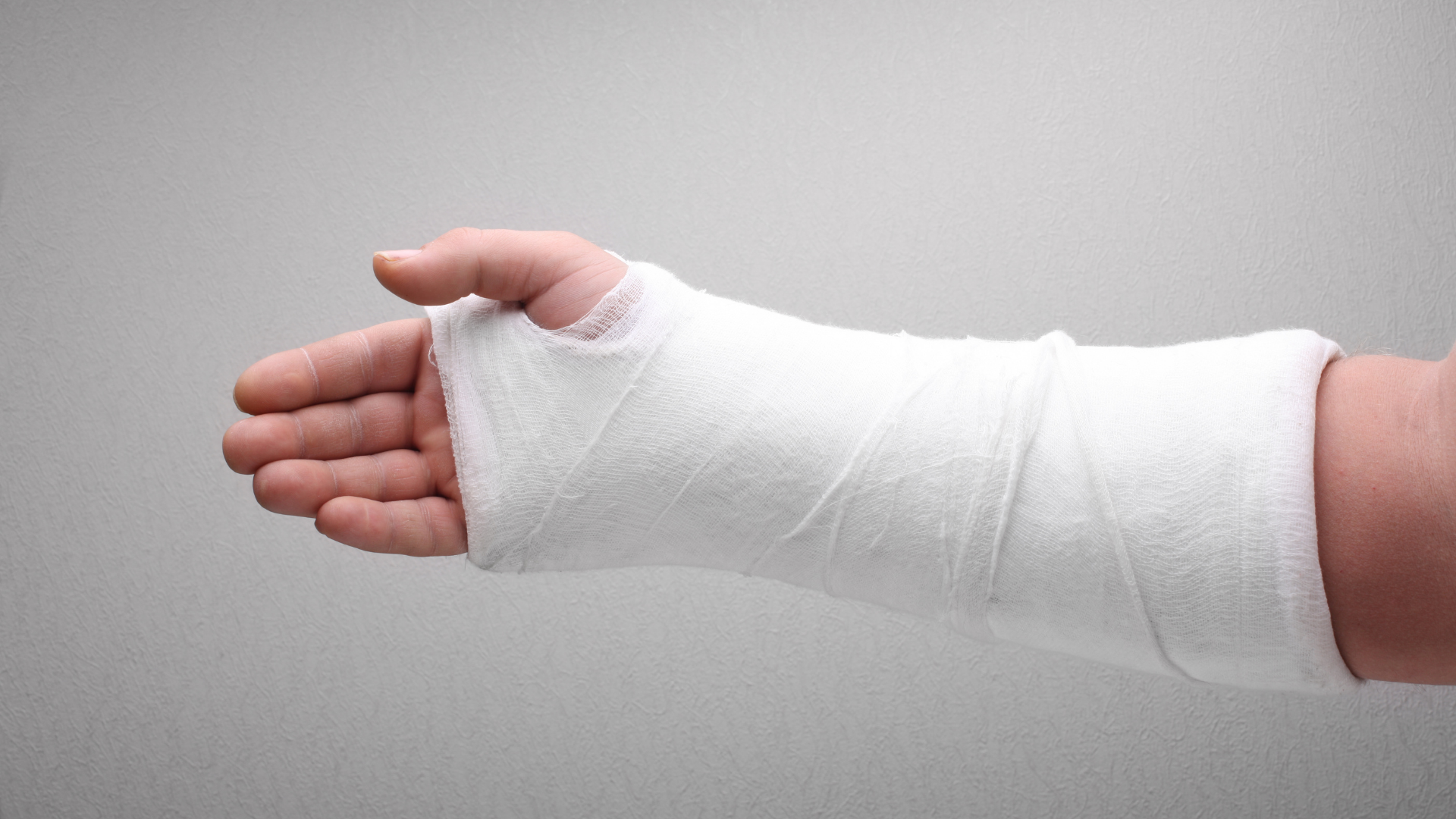 Cast