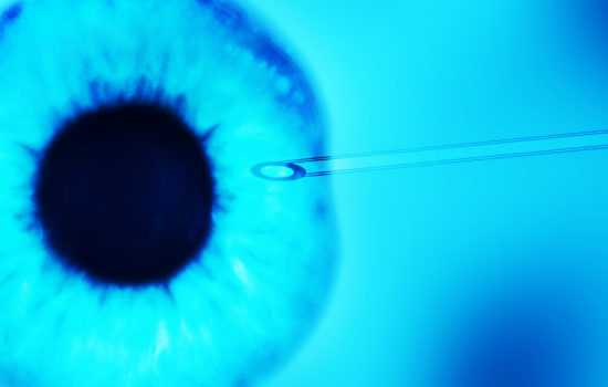 Eye Surgery