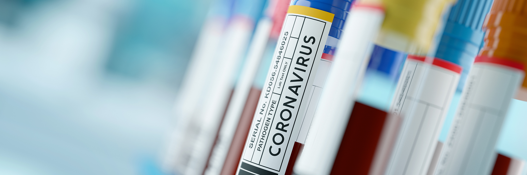 Coronavirus 2019-nCoV Blood Samples Medical Concept