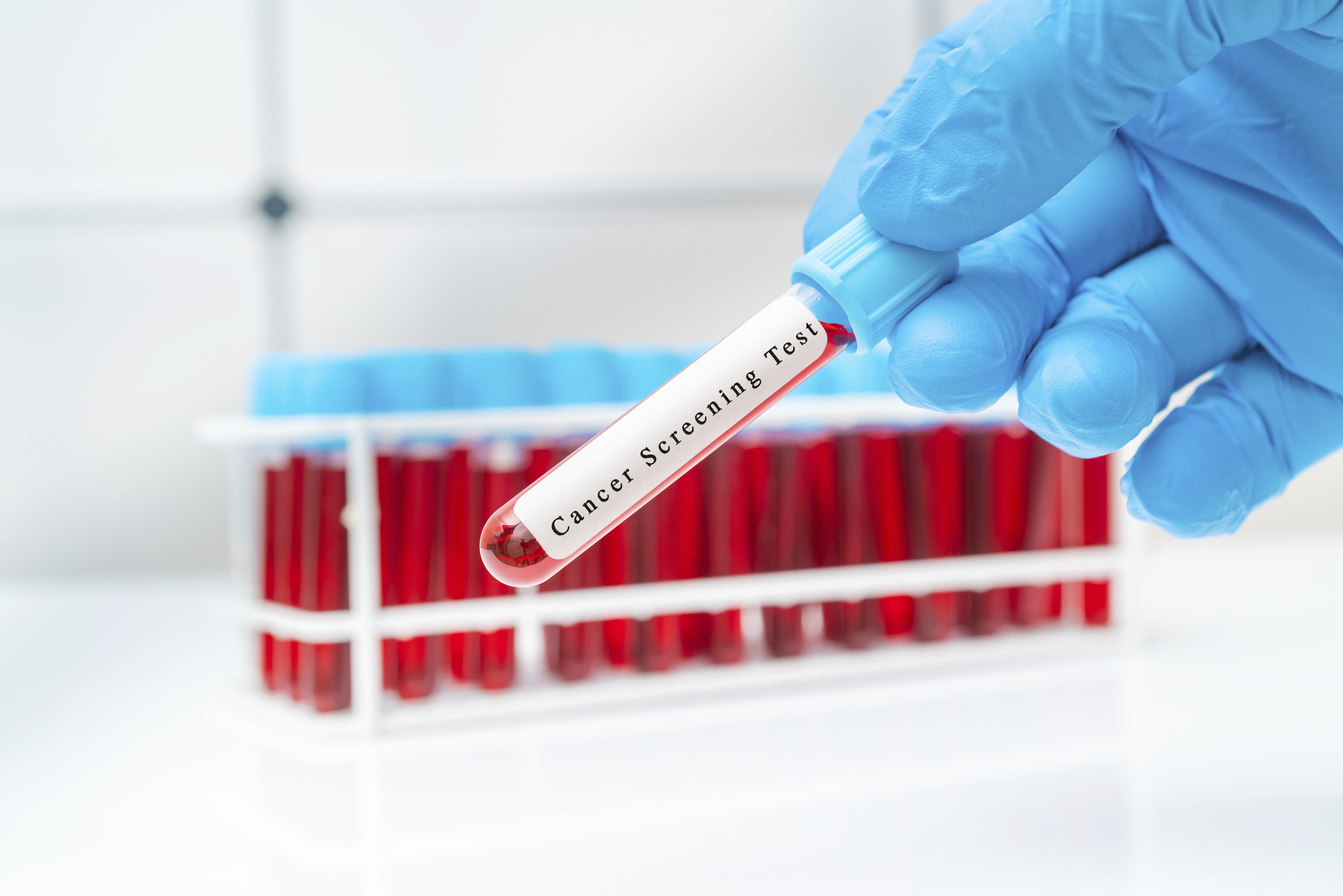 Preliminary Injunction Halts Sales of Tumor-Informed Cancer Screening Test