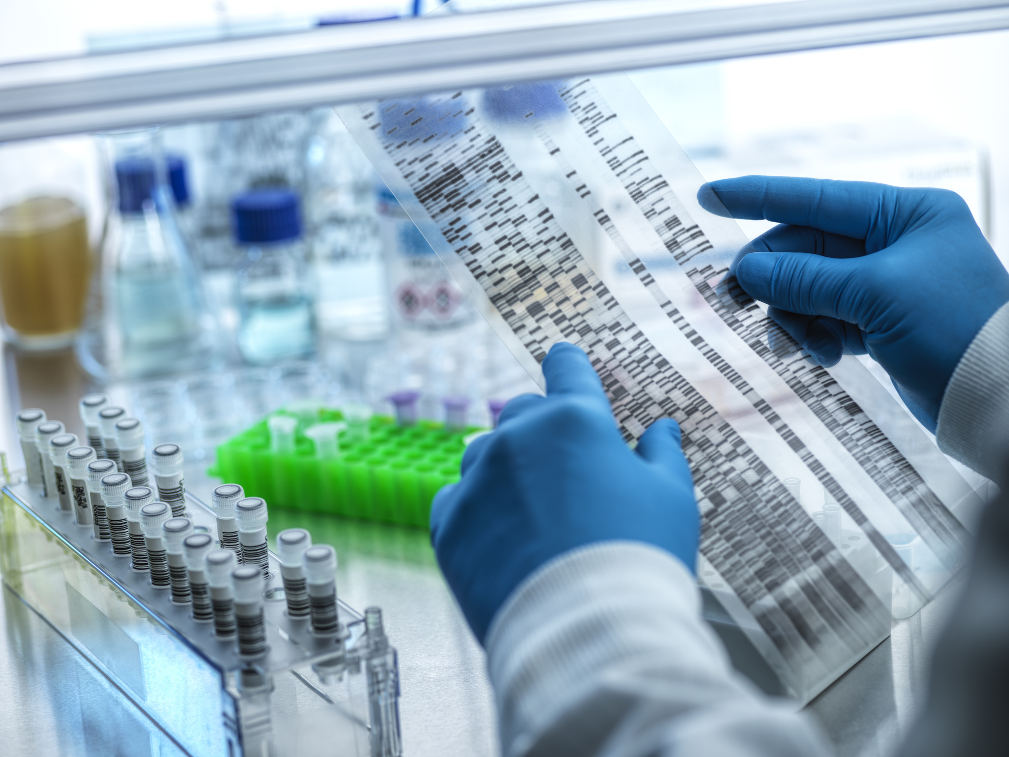 Federal Circuit Vacates $4.7 Million Patent Infringement Verdict