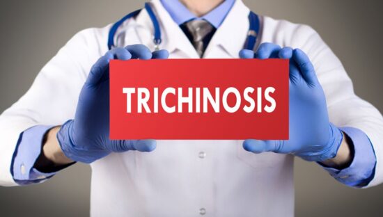 dreamstime_trichinosis trichinella foodborne parasites meat