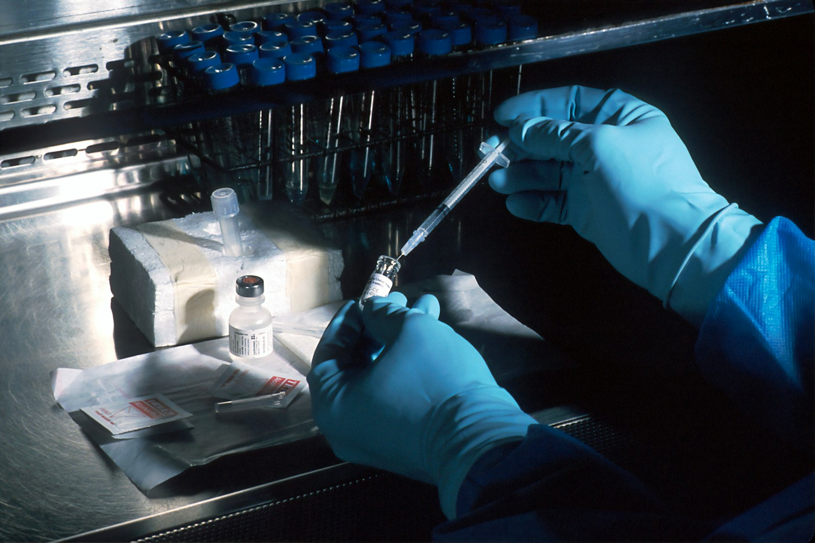 Vaccine. Hands of a scientist, under a sterile hood, preparing the carcinoembryonic antigen (CEA) vaccinia used to try to prevent cancer. The scientist is diluting the concentrated vaccinnia virus into a dose level appropriate for administration to a patient. This vaccinnia marks any cancer cells expressing the CEA.