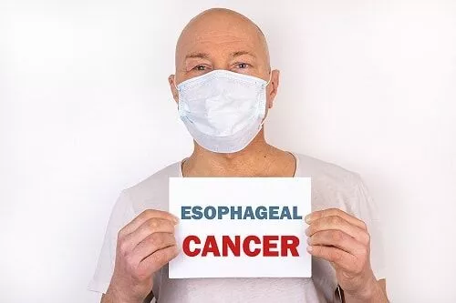 https-www-911victimlawyer-com-hubfs-esophageal-cancer-1-webp