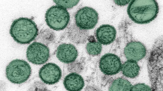 Hantavirus_crop_green_300dpi