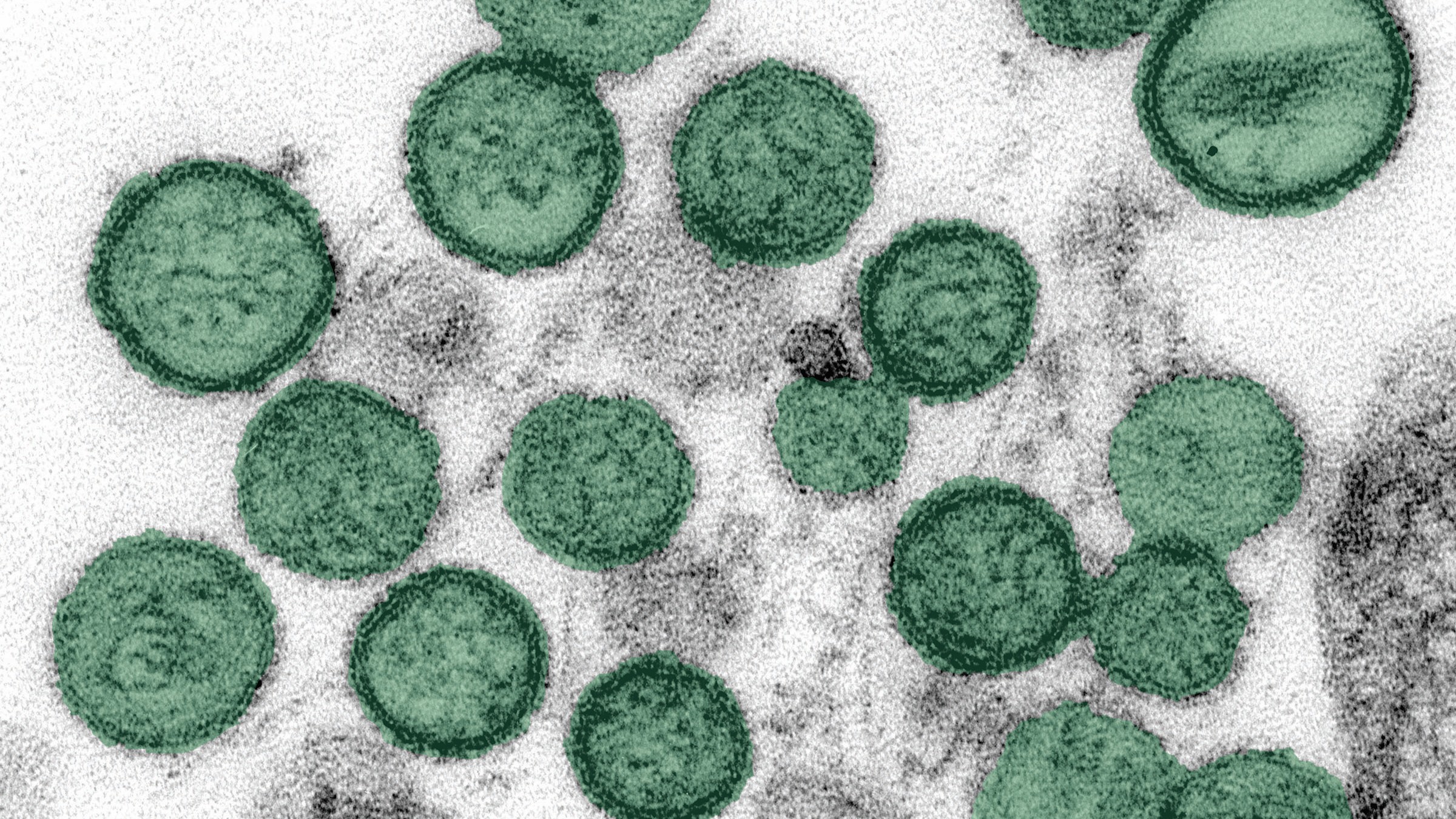 Hantavirus_crop_green_300dpi