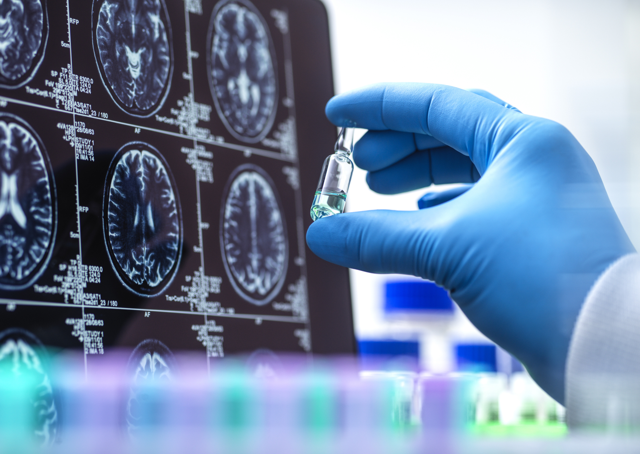 Trip Advisor: FDA Publishes Guidance on Psychedelic Drug Trials