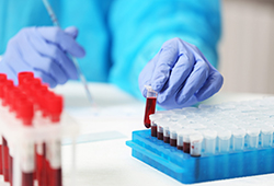 https-www-lifesciencesperspectives-com-wp-content-uploads-sites-10-2021-01-shutterstock_640079848-scaled_250x170-jpg